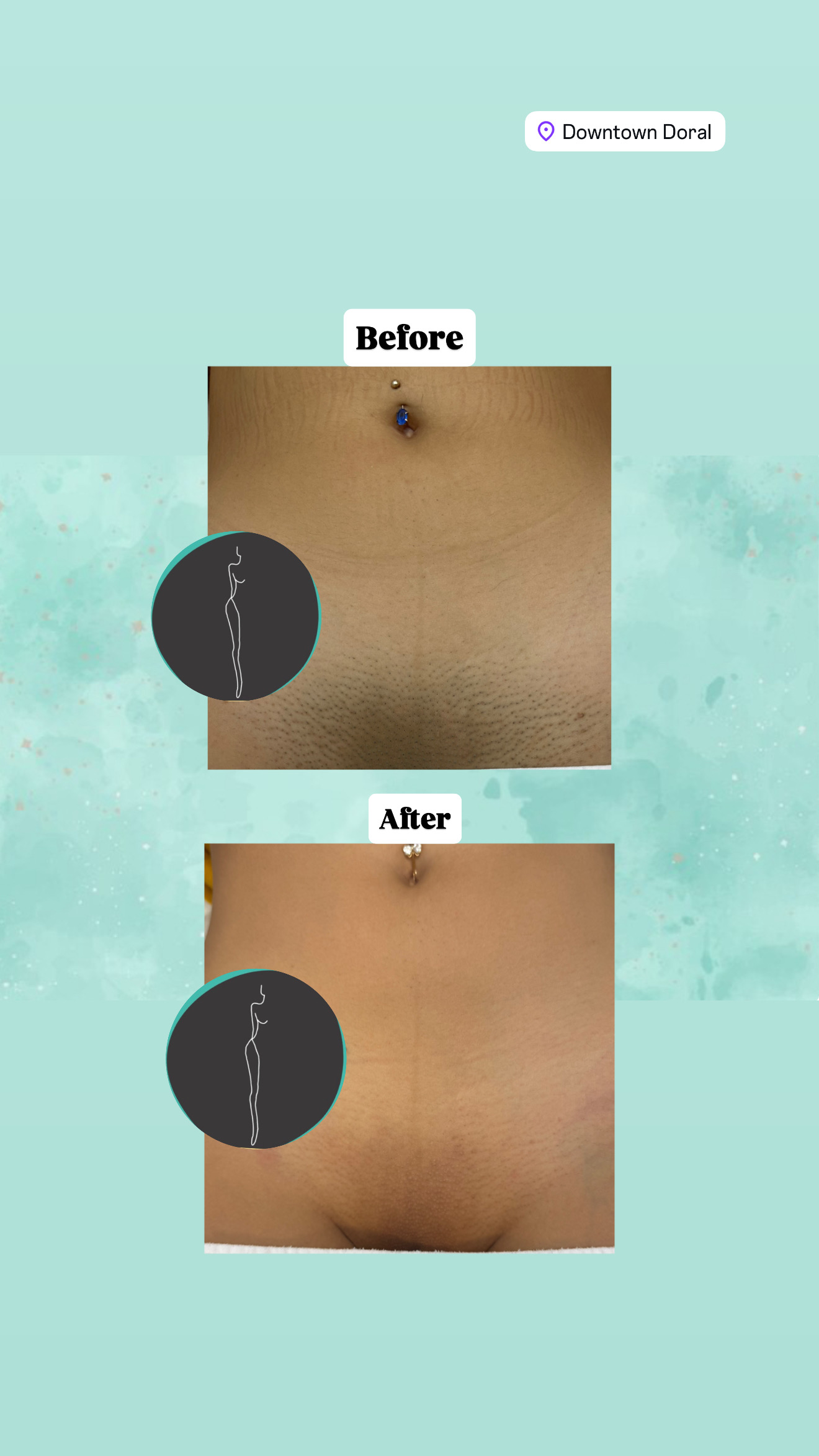 JH LASER CENTER