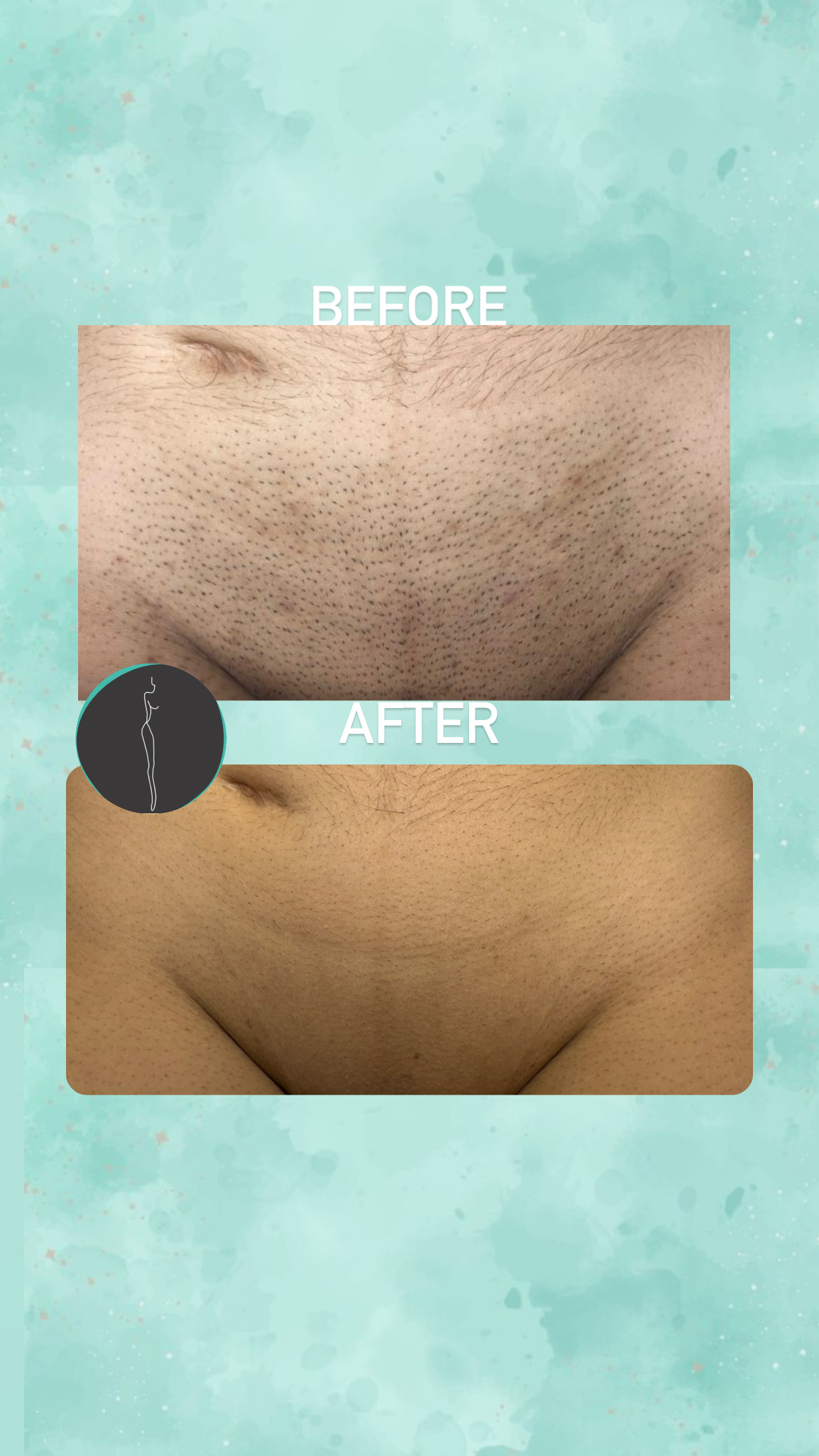 JH LASER CENTER