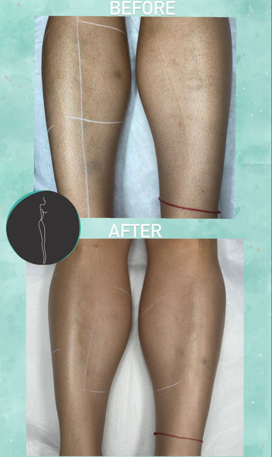 JH LASER CENTER
